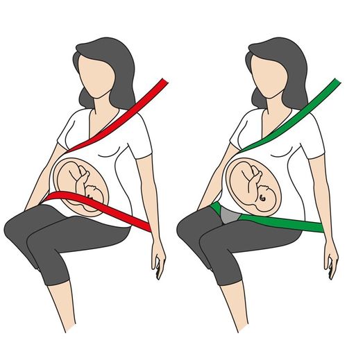 חגורת בטיחות לנשים בהריון BeSafe Pregnant