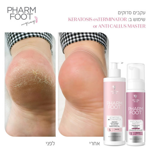 ג’ל ריכוך להסרת עור יבש ברגליים וקאלוס Pharm Foot | KERATOSIS exTERMINATOR