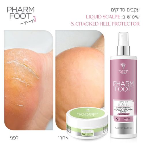 קרם אוזון לטיפול בעקבים סדוקים 75 מ