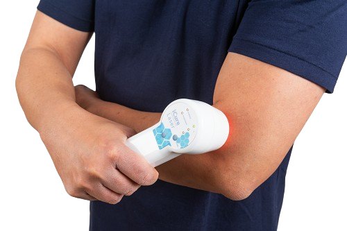 מכשיר icure laser | איי קיור לייזר לטיפול בכאבים ודלקות