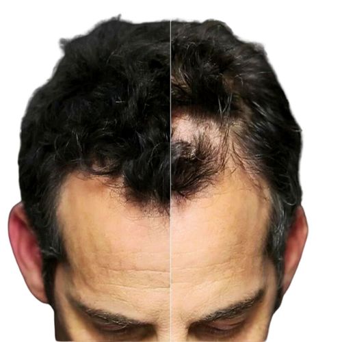 סיבי שיער טופיק 3 גרם