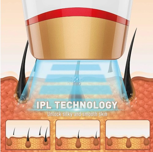 מכשיר ביתי להסרת שיער IPL דגם: MC-1280 