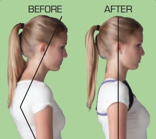 משפר יציבה Posture Medic | מידה L | מסייע ובמתיחה וחיזוק של שרירי הגב והצוואר |