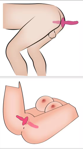 ויברטור זוגי 