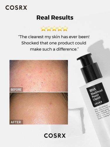 סרום - Bha blackhead power liquid