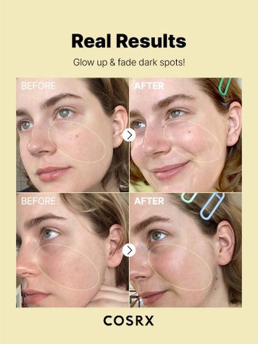 The vitamin c 23(serum)