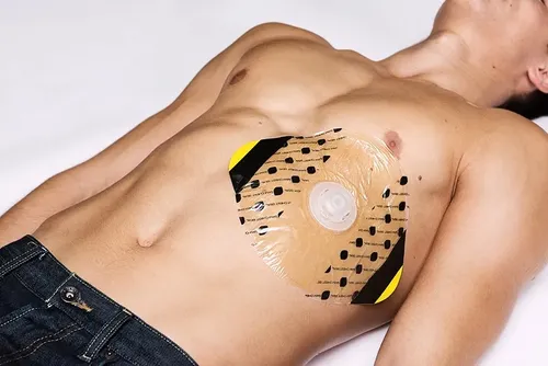 חבישה לפציעת חזה חודרת - CHEST SEAL