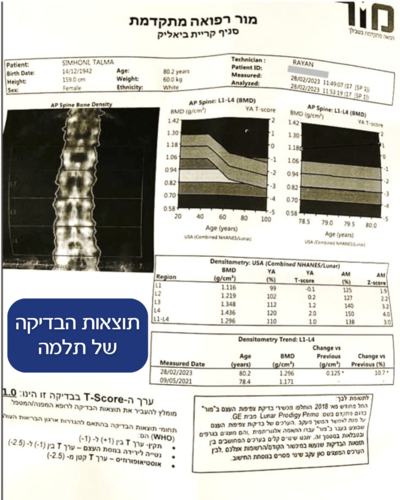 3 יחידות קלציק2 במבצע