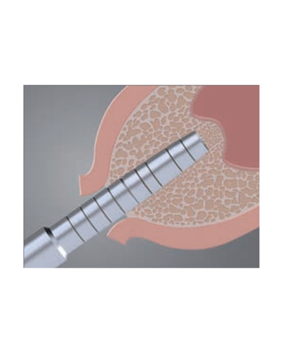מכשיר להרמות סינוס Anthogyr Osteo Safe