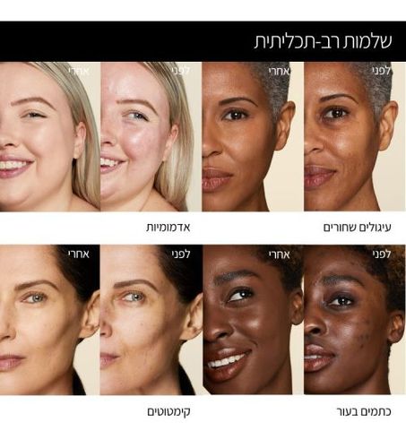 קונסילר - Concealer (light 2.6)
