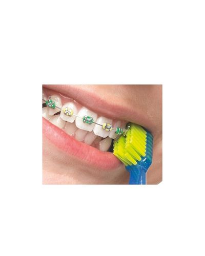 מברשת שיניים CS 5460 ORTHO ULTRA SOFT לשימוש בטיפול אורתודנטי קורפרוקס | מביל 5460 סיבים | טבע זול