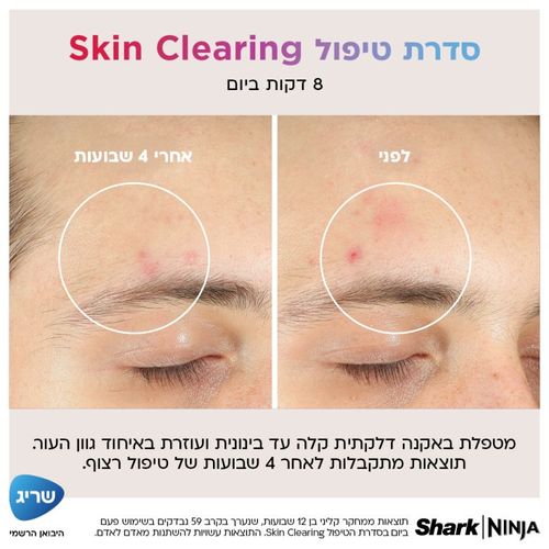 מסכת LED טיפולית לעור הפנים Shark FW312EU CryoGlow - אחריות ע