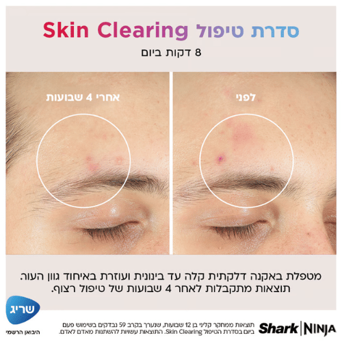 מסכת לד לעור הפנים Shark Beauty CryoGlow FW312EU