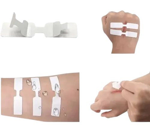 פלסטר פרפריות - 100 יחידות בחבילה
