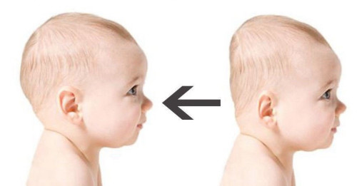 כרית תינוק עם שקע למניעת ראש שטוח - לבן