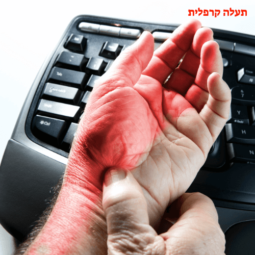 תעלה קרפלית